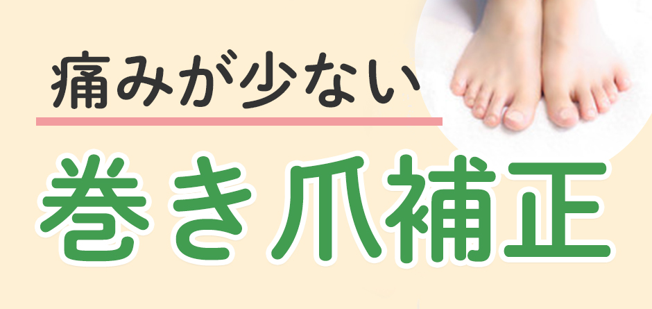 痛みが少ない巻き爪補正