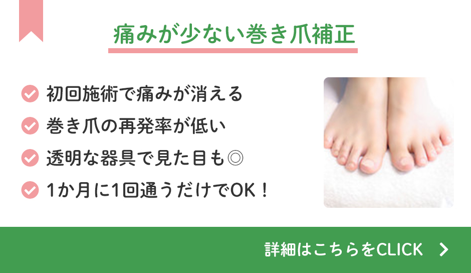 痛みが少ない巻き爪補正